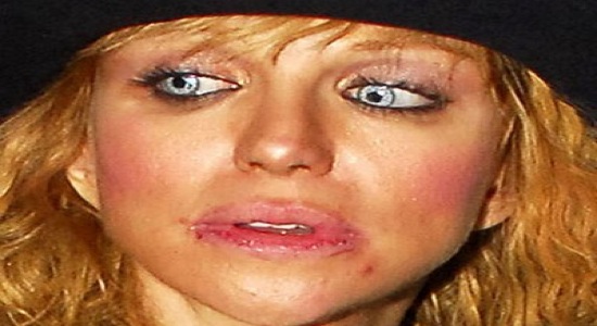 Courtney Love WTF is going on with her lips
