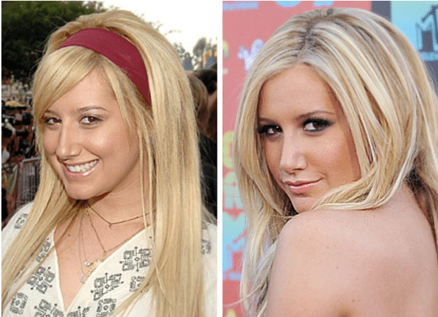 ashley-tisdale-before-and-after-nose-job-plastic-surgery-photos